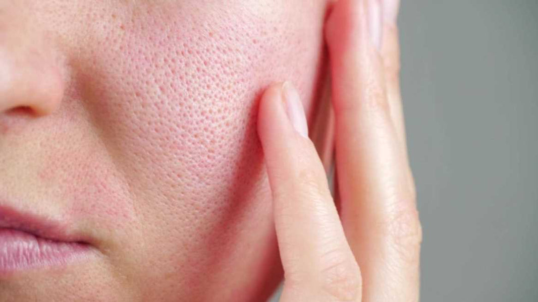 Optimizing Skin Healing After Cosmetic Procedures: A Guide for Skincare Therapists