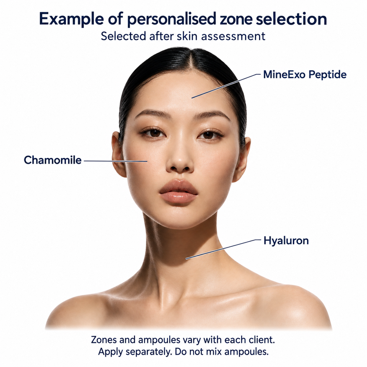 Example of assessed facial and neck zones using MineExo Peptide, Chamomile and Hyaluron; selections vary by client and ampoules are applied separately.