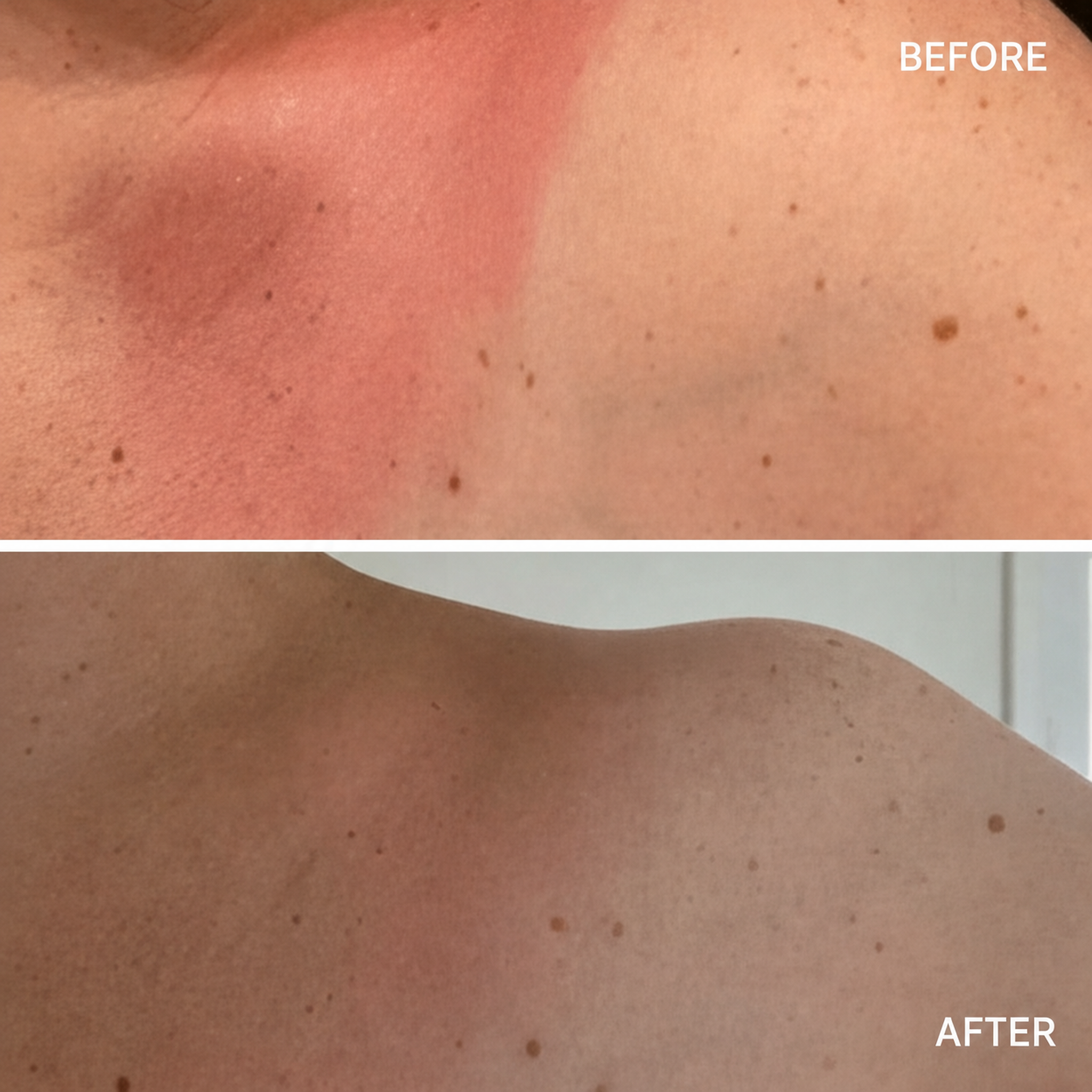 Waterlily Cooling Botanical Wrap before and after image showing reduced redness and calmer sun-exposed skin.